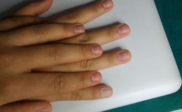 Protez Tirnak Kursu Izmir Biotin Guzellik